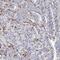 Tripartite Motif Containing 9 antibody, FNab08995, FineTest, Immunohistochemistry paraffin image 