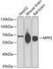 Membrane Palmitoylated Protein 2 antibody, GTX33322, GeneTex, Western Blot image 