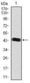 Fibroblast Growth Factor Receptor 3 antibody, NBP2-52469, Novus Biologicals, Western Blot image 