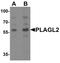 PLAG1 Like Zinc Finger 2 antibody, PA5-34457, Invitrogen Antibodies, Western Blot image 