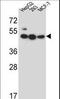Lipase Family Member J antibody, LS-C165795, Lifespan Biosciences, Western Blot image 