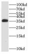 RCC1 And BTB Domain Containing Protein 1 antibody, FNab07205, FineTest, Western Blot image 