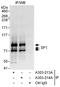 Splicing Factor 1 antibody, A303-214A, Bethyl Labs, Immunoprecipitation image 