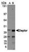 DEP Domain Containing MTOR Interacting Protein antibody, TA309623, Origene, Western Blot image 