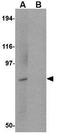 Protein bicaudal D homolog 1 antibody, GTX85029, GeneTex, Western Blot image 
