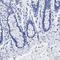 Triggering Receptor Expressed On Myeloid Cells Like 1 antibody, HPA016700, Atlas Antibodies, Immunohistochemistry paraffin image 
