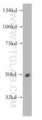 ACBP antibody, 13385-1-AP, Proteintech Group, Western Blot image 