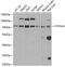 Cytochrome P450 Family 3 Subfamily A Member 4 antibody, 18-699, ProSci, Western Blot image 
