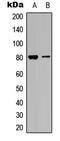 Microtubule Associated Protein Tau antibody, LS-C368445, Lifespan Biosciences, Western Blot image 