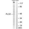 1-Acylglycerol-3-Phosphate O-Acyltransferase 5 antibody, PA5-49935, Invitrogen Antibodies, Western Blot image 