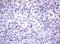 Hdm2 antibody, LS-C336392, Lifespan Biosciences, Immunohistochemistry paraffin image 