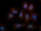 C-Src kinase antibody, SM3138P, Origene, Immunofluorescence image 