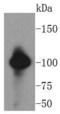 Vav Guanine Nucleotide Exchange Factor 2 antibody, A03014-1, Boster Biological Technology, Western Blot image 