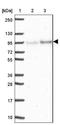 Epsin 3 antibody, NBP2-49188, Novus Biologicals, Western Blot image 