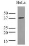 Lactate Dehydrogenase A antibody, GTX50001, GeneTex, Western Blot image 