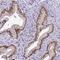 Survival Of Motor Neuron 2, Centromeric antibody, NBP2-46712, Novus Biologicals, Immunohistochemistry paraffin image 