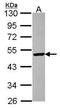 ST3 Beta-Galactoside Alpha-2,3-Sialyltransferase 5 antibody, PA5-30289, Invitrogen Antibodies, Western Blot image 
