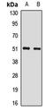 Small Nuclear Ribonucleoprotein U1 Subunit 70 antibody, orb412427, Biorbyt, Western Blot image 
