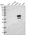 Methionine Adenosyltransferase 1A antibody, PA5-61784, Invitrogen Antibodies, Western Blot image 