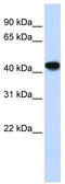 Alcohol Dehydrogenase 1B (Class I), Beta Polypeptide antibody, TA346212, Origene, Western Blot image 