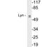 LYN Proto-Oncogene, Src Family Tyrosine Kinase antibody, LS-C199919, Lifespan Biosciences, Western Blot image 