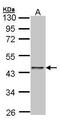 E2F-1 antibody, PA5-27365, Invitrogen Antibodies, Western Blot image 