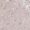 Prolylendopeptidase-like antibody, NBP2-31868, Novus Biologicals, Immunohistochemistry frozen image 