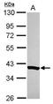 NADH:Ubiquinone Oxidoreductase Complex Assembly Factor 5 antibody, GTX119214, GeneTex, Western Blot image 