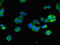 Dihydropyrimidine dehydrogenase [NADP+] antibody, orb47055, Biorbyt, Immunofluorescence image 