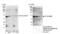 E3 ubiquitin-protein ligase DTX3L antibody, NB100-2873, Novus Biologicals, Immunoprecipitation image 