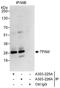 Transcription Factor A, Mitochondrial antibody, A303-225A, Bethyl Labs, Immunoprecipitation image 