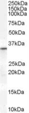 B36-VDAC antibody, NBP1-68794, Novus Biologicals, Western Blot image 