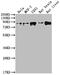 Valosin Containing Protein antibody, CSB-RA182227A0HU, Cusabio, Western Blot image 