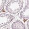 24-Dehydrocholesterol Reductase antibody, HPA017981, Atlas Antibodies, Immunohistochemistry frozen image 