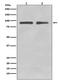 Forkhead Box O3 antibody, M00252-1, Boster Biological Technology, Western Blot image 