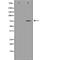 Lamina-associated polypeptide 2, isoforms beta/gamma antibody, orb229129, Biorbyt, Western Blot image 