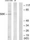 Ribosomal Protein S6 Kinase B1 antibody, TA326218, Origene, Western Blot image 