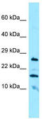 Cerebellin 3 Precursor antibody, TA338332, Origene, Western Blot image 