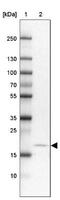 Calcyon Neuron Specific Vesicular Protein antibody, NBP1-91225, Novus Biologicals, Western Blot image 