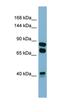 Peroxidasin antibody, orb324998, Biorbyt, Western Blot image 