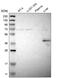 Cyclin-dependent kinase 14 antibody, HPA015267, Atlas Antibodies, Western Blot image 