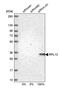 Ribosomal Protein L13 antibody, PA5-62462, Invitrogen Antibodies, Western Blot image 