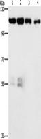 Cyclin Dependent Kinase 11A antibody, TA351062, Origene, Western Blot image 