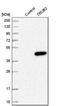 TruB Pseudouridine Synthase Family Member 2 antibody, NBP1-85560, Novus Biologicals, Western Blot image 