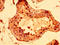 Stromal Antigen 3 antibody, LS-C673049, Lifespan Biosciences, Immunohistochemistry paraffin image 