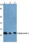 Dscr1 antibody, A02795, Boster Biological Technology, Western Blot image 