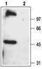 Short transient receptor potential channel 6 antibody, TA328733, Origene, Western Blot image 