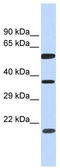 5'-Nucleotidase Domain Containing 1 antibody, TA329780, Origene, Western Blot image 