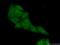 Proteasome Subunit Beta 9 antibody, 14544-1-AP, Proteintech Group, Immunofluorescence image 