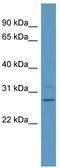 Phosphoserine Phosphatase antibody, TA342221, Origene, Western Blot image 